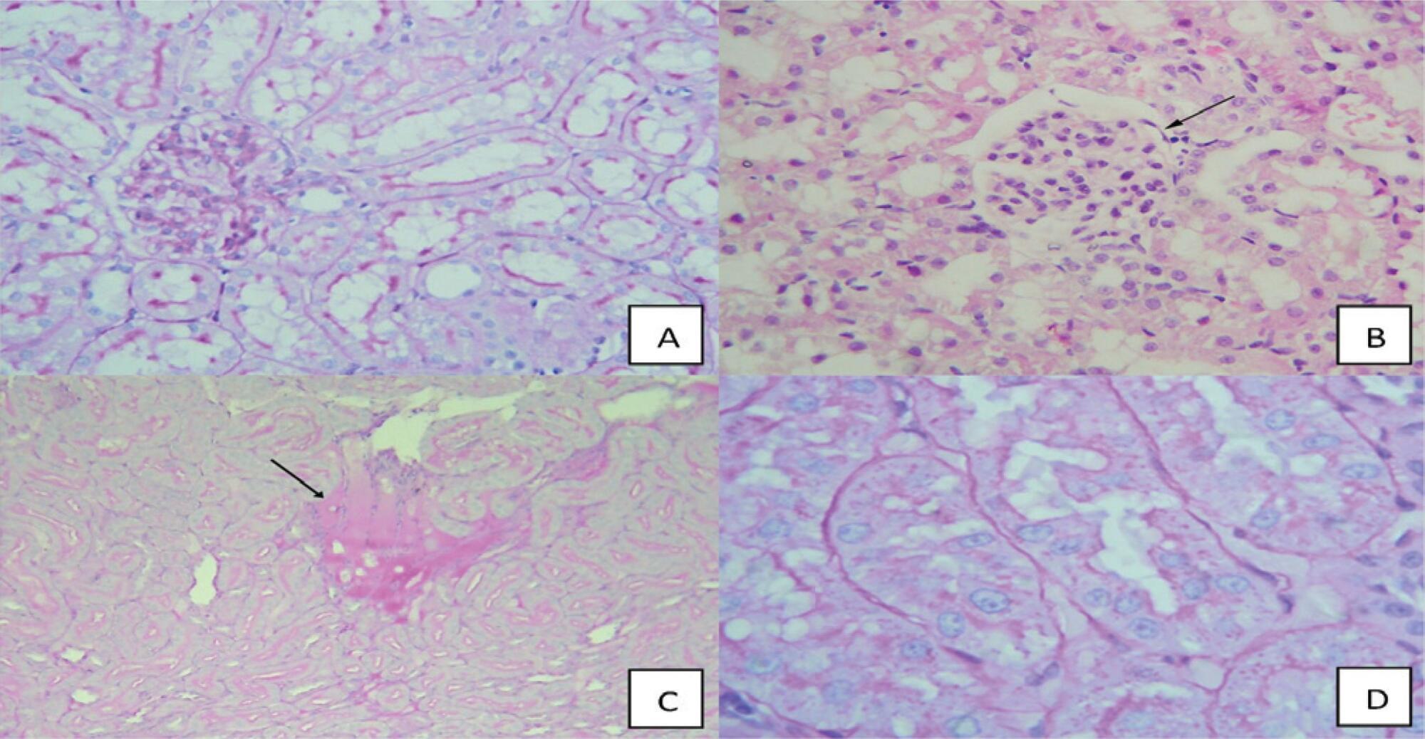 Sepsis-induced acute kidney injury: kidney protection effects by antioxidants
