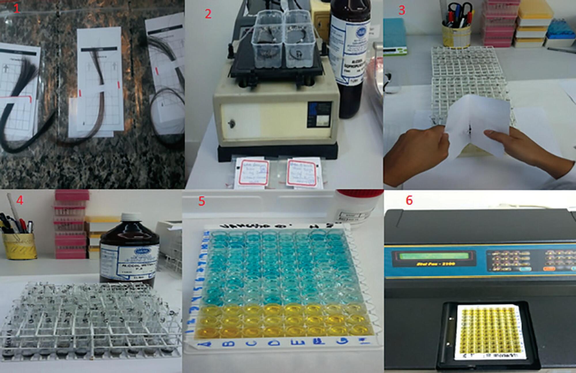 Estresse e níveis de cortisol capilar entre a equipe de enfermagem
