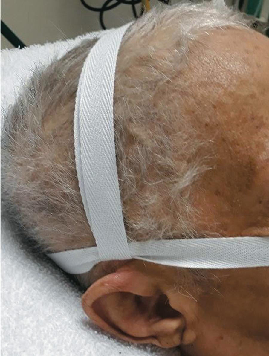 Medical device-related pressure injury prevention in critically ill patients: nursing care