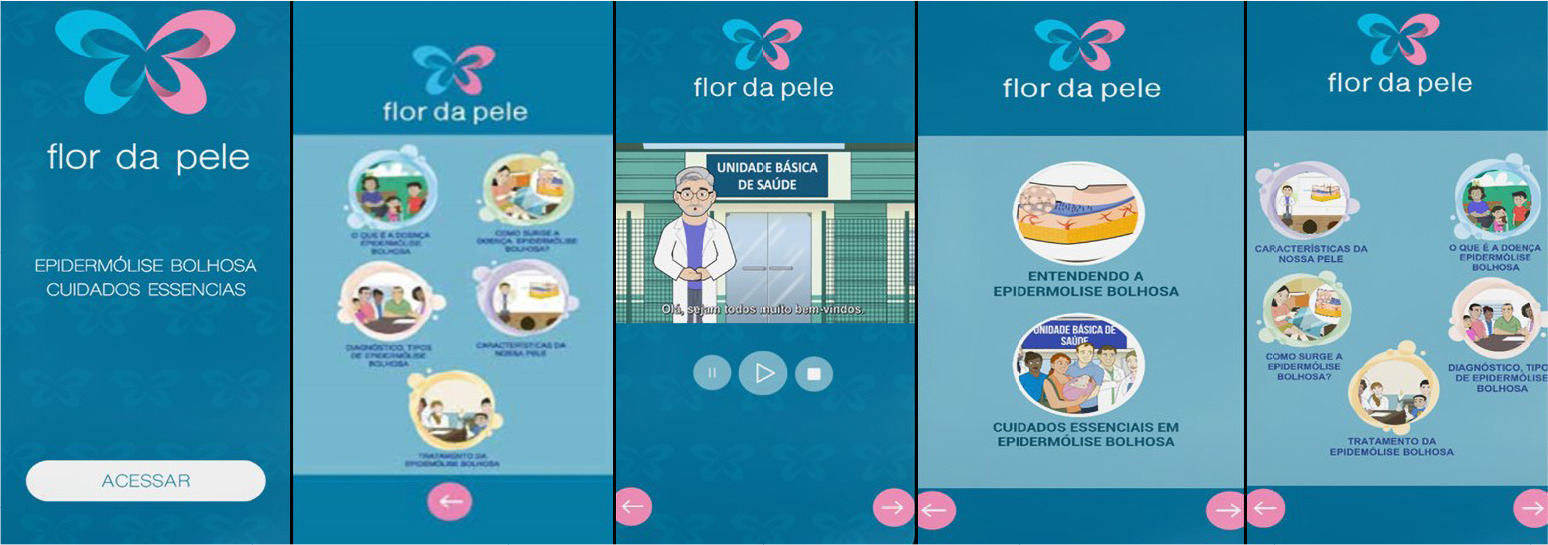 Desenvolvimento e validação de hipermídia educativa para familiares e cuidadores de pessoas com epidermólise bolhosa