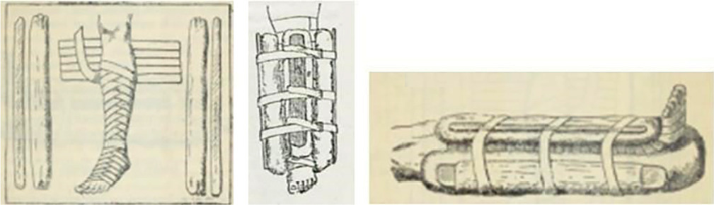 Nursing, history, and orthopedics in manuals (1875-1928)