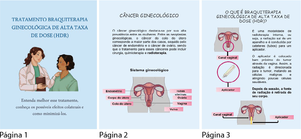 Estudo de validação de tecnologia educativa sobre braquiterapia ginecológica de alta taxa de dose (HDR)